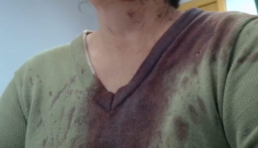Mulher é presa após atacar irmã com cabo de aço no Paraná