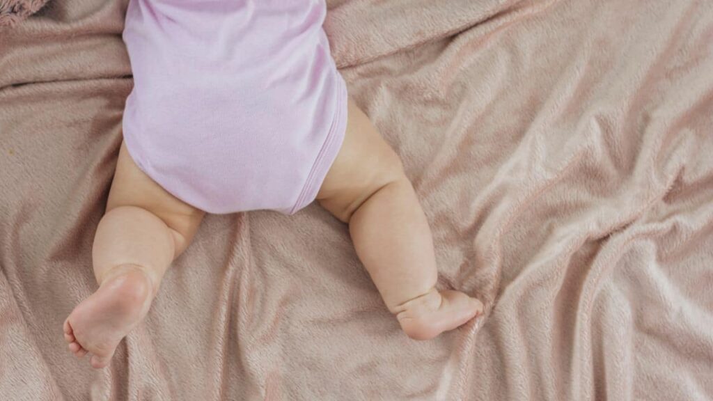 Como prevenir e tratar assadura em bebês?